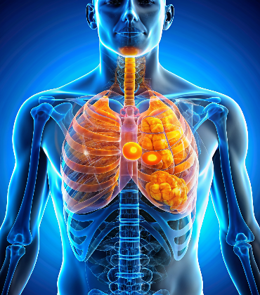 chest-wall-tumors