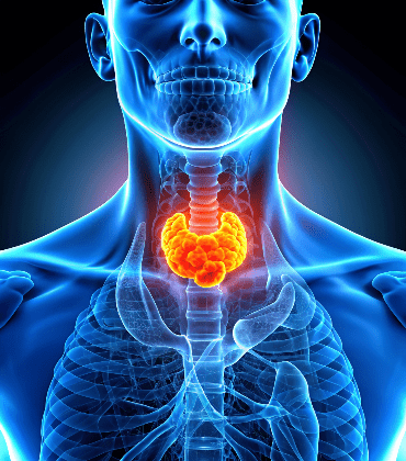 thymoma