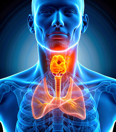 tracheal-cancer